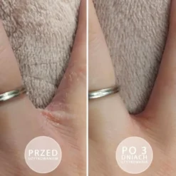 Beautica S.O.S. intensywnie natłuszczająca maść do dłoni i stóp z witaminą E 100 ml