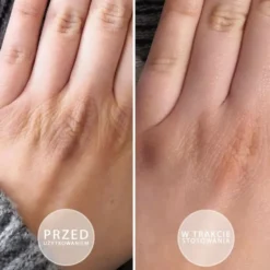 Beautica S.O.S. intensywnie natłuszczająca maść do dłoni i stóp z witaminą E 100 ml