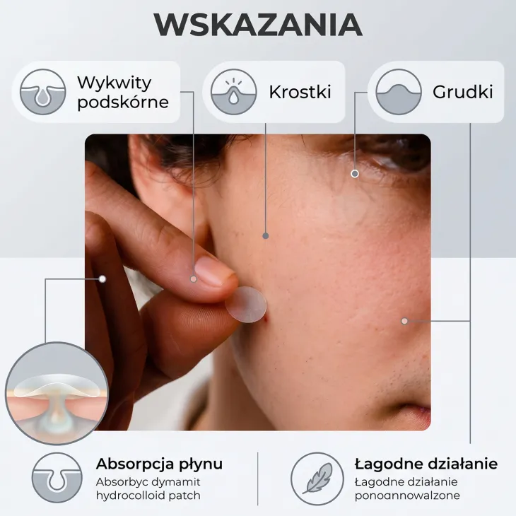 L'Biotica Home SPA punktowe plasterki na wypryski Redukcja Niedoskonałości 3 x 12 sztuk
