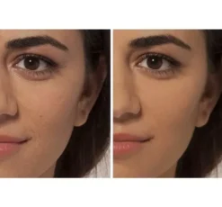 L'Oréal Paris True Match korektor Beige 4 N 6,8 ml