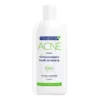Novaclear Acne oczyszczający tonik do mycia twarzy 150 ml
