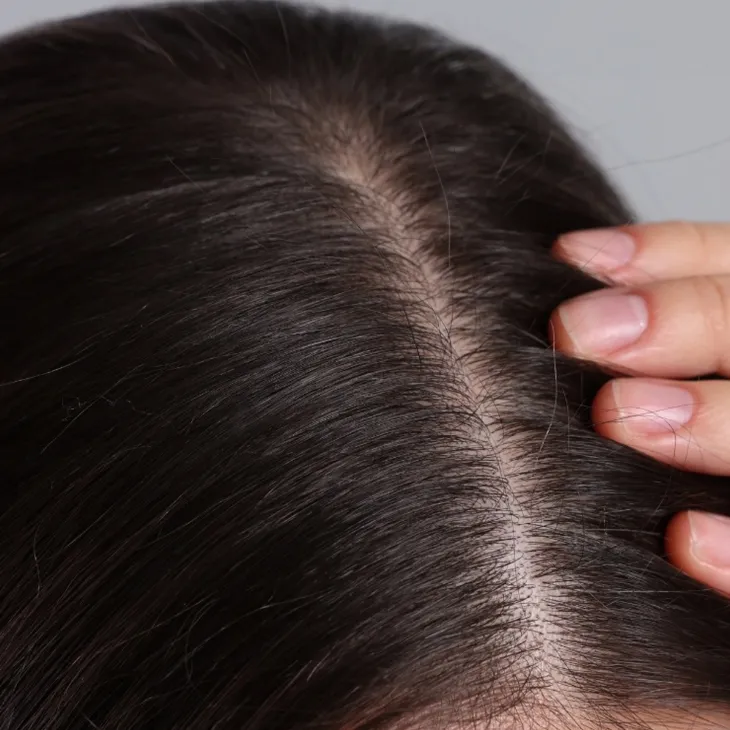 Seboradin Forte Scalp Serum wcierka z masażerem wzmacniająco-zagęszczająca włosy 100 ml
