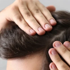 Seboradin Men Forte Scalp Serum wcierka z masażerem zagęszczająca włosy i brodę 100 ml
