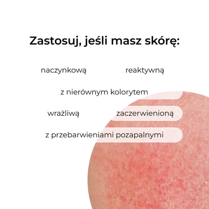 Veoli Botanica Redness Whisperer wyciszająco-chłodzące serum na naczynka 30 ml